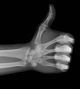 Permanent Recruit Radiologist